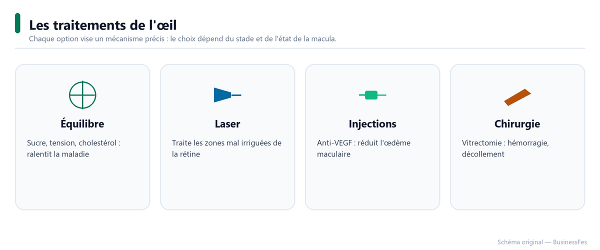 Traitements de l'œil